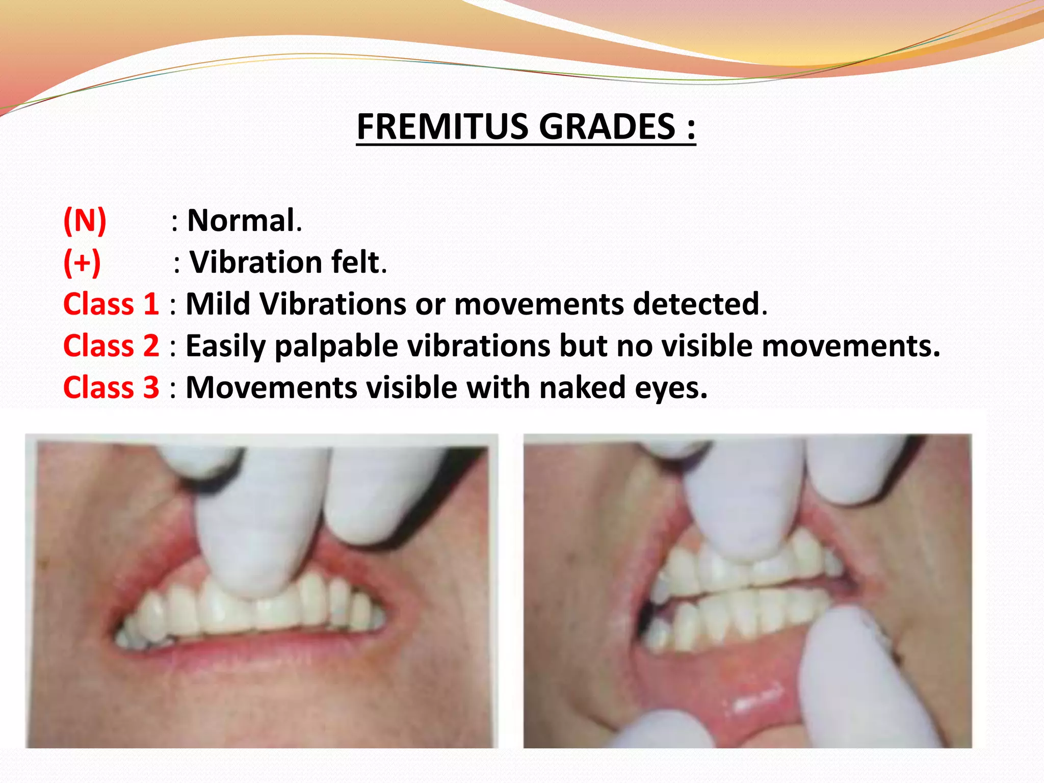 FREMITUS GRADES :
(N) : Normal.
(+) : Vibration felt.
Class 1 : Mild Vibrations or movements detected.
Class 2 : Easily palpable vibrations but no visible movements.
Class 3 : Movements visible with naked eyes.
 