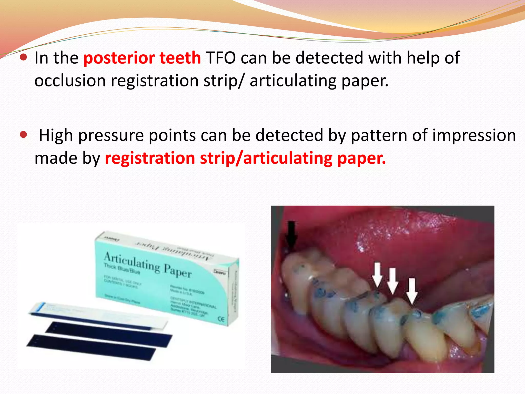 In the posterior teeth TFO can be detected with help of
occlusion registration strip/ articulating paper.
 High pressure points can be detected by pattern of impression
made by registration strip/articulating paper.
 