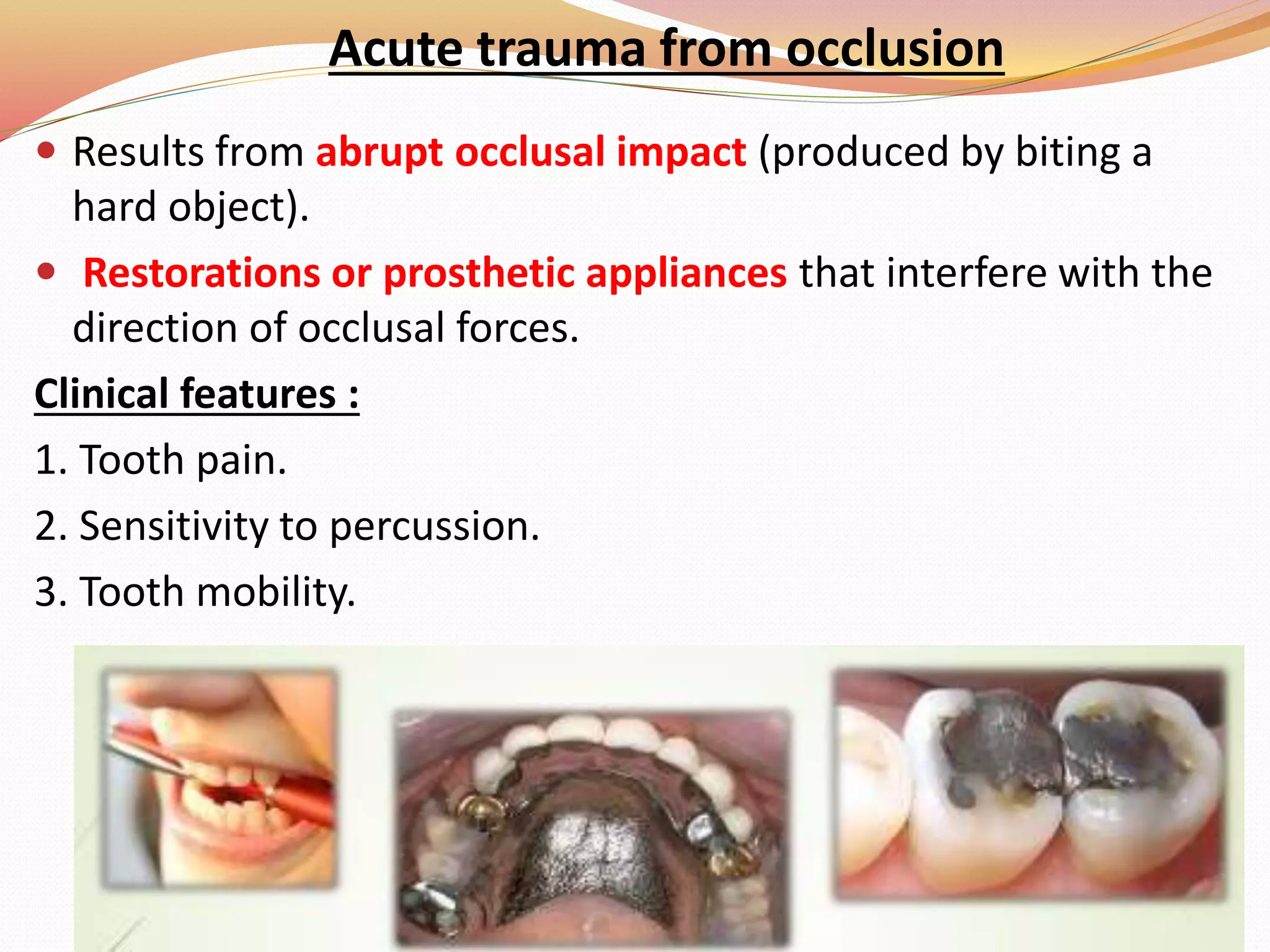 Acute trauma from occlusion
 Results from abrupt occlusal impact (produced by biting a
hard object).
 Restorations or prosthetic appliances that interfere with the
direction of occlusal forces.
Clinical features :
1. Tooth pain.
2. Sensitivity to percussion.
3. Tooth mobility.
 