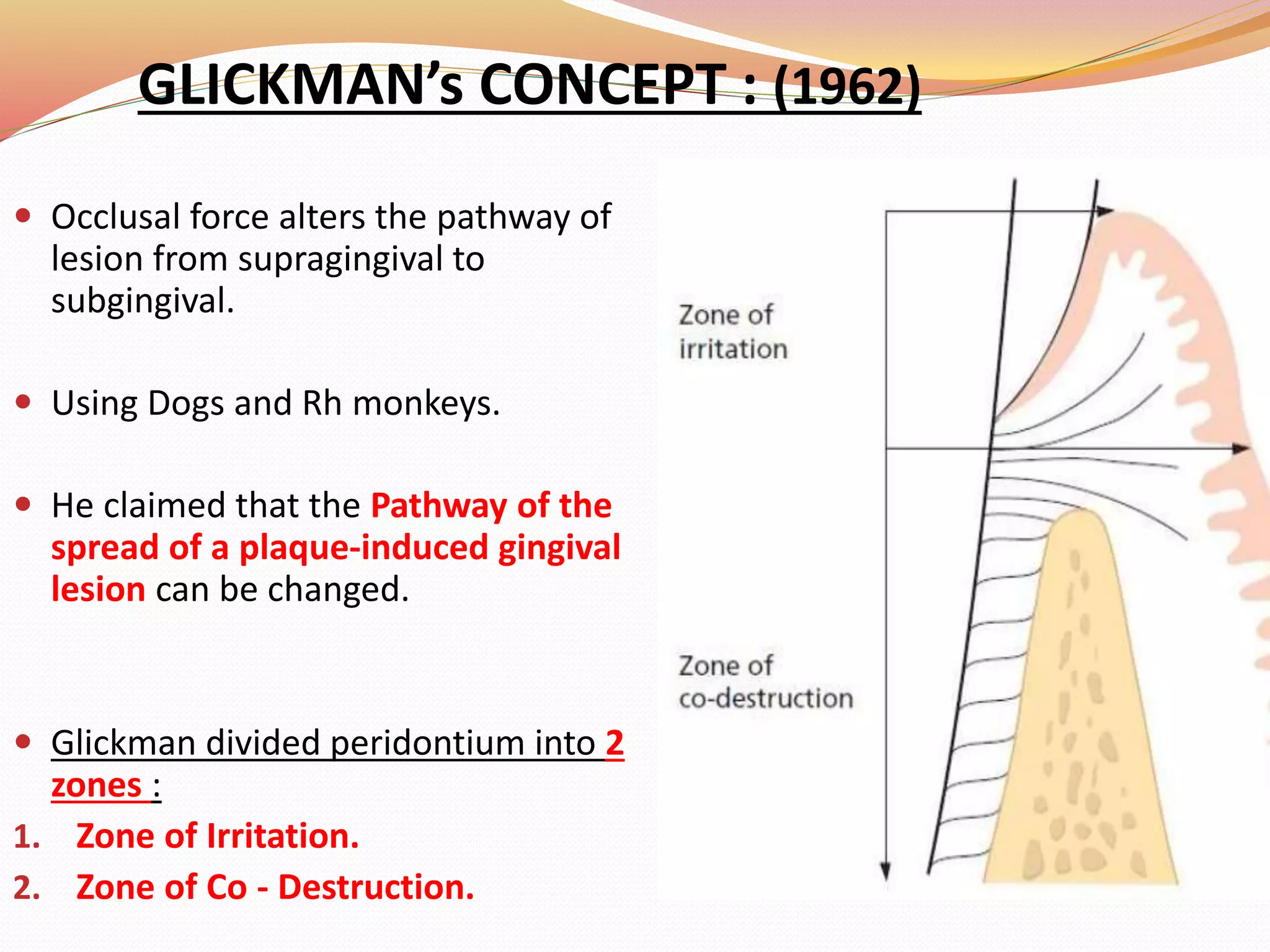 GLICKMAN’s CONCEPT : (1962)
 Occlusal force alters the pathway of
lesion from supragingival to
subgingival.
 Using Dogs and Rh monkeys.
 He claimed that the Pathway of the
spread of a plaque‐induced gingival
lesion can be changed.
 Glickman divided peridontium into 2
zones :
1. Zone of Irritation.
2. Zone of Co - Destruction.
 