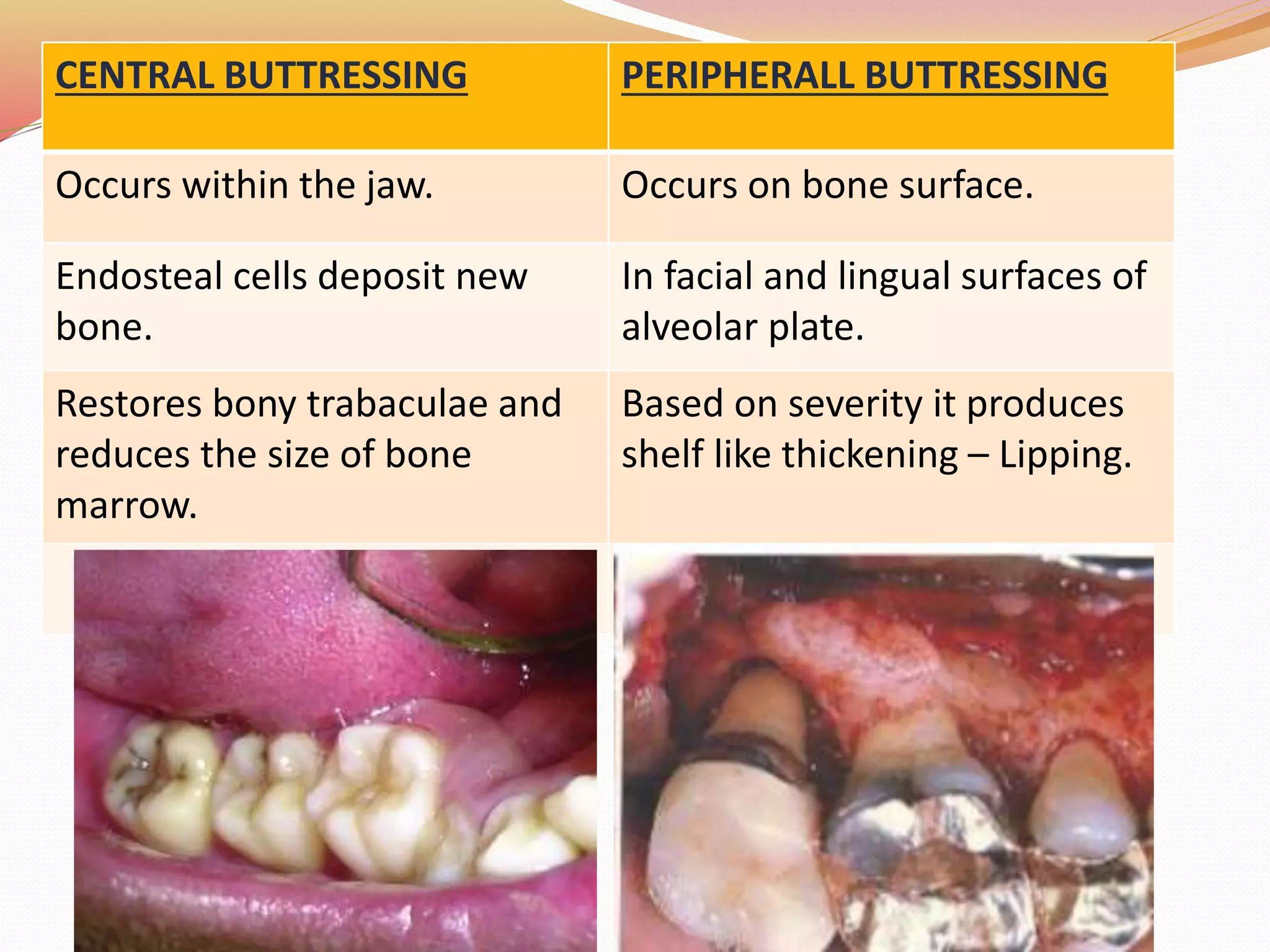 CENTRAL BUTTRESSING PERIPHERALL BUTTRESSING
Occurs within the jaw. Occurs on bone surface.
Endosteal cells deposit new
bone.
In facial and lingual surfaces of
alveolar plate.
Restores bony trabaculae and
reduces the size of bone
marrow.
Based on severity it produces
shelf like thickening – Lipping.
 