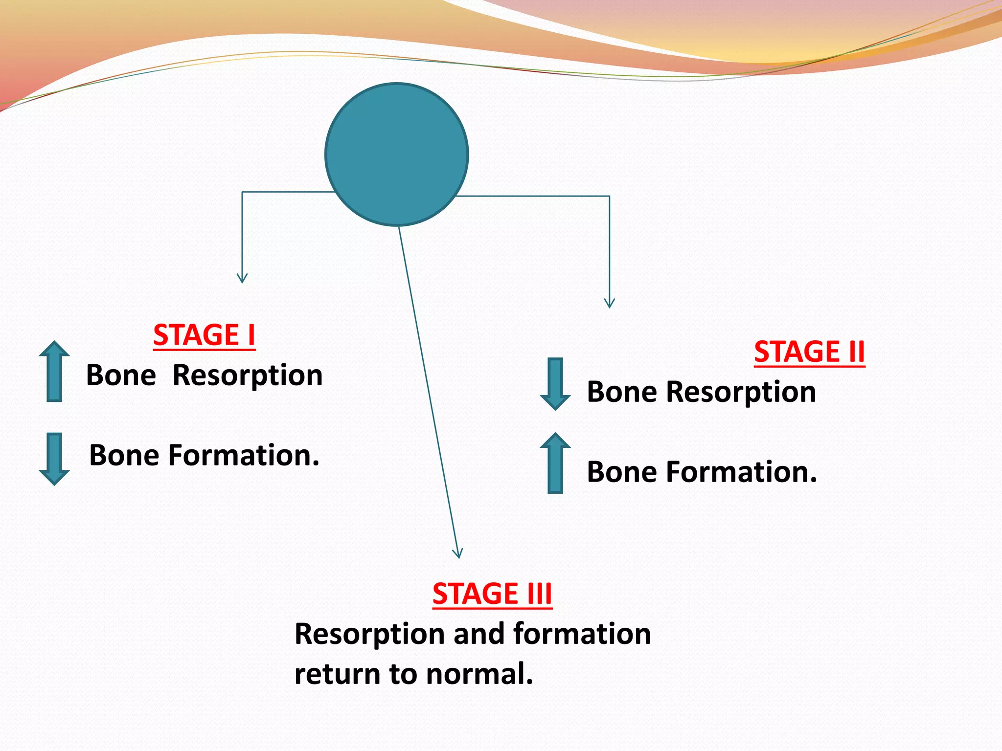 STAGE I
Bone Resorption
Bone Formation.
STAGE II
Bone Resorption
Bone Formation.
STAGE III
Resorption and formation
return to normal.
 
