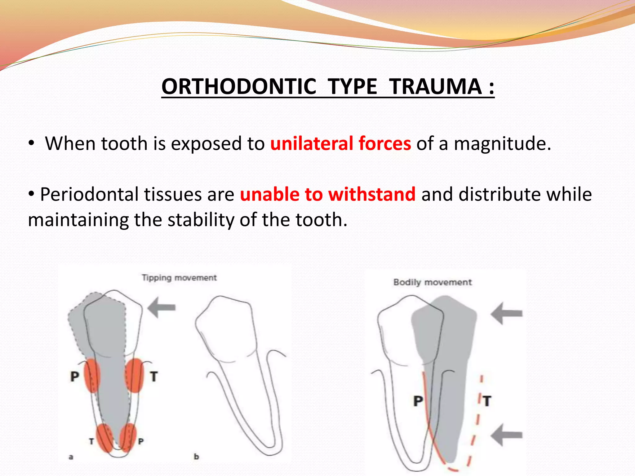 ORTHODONTIC TYPE TRAUMA :
• When tooth is exposed to unilateral forces of a magnitude.
• Periodontal tissues are unable to withstand and distribute while
maintaining the stability of the tooth.
 