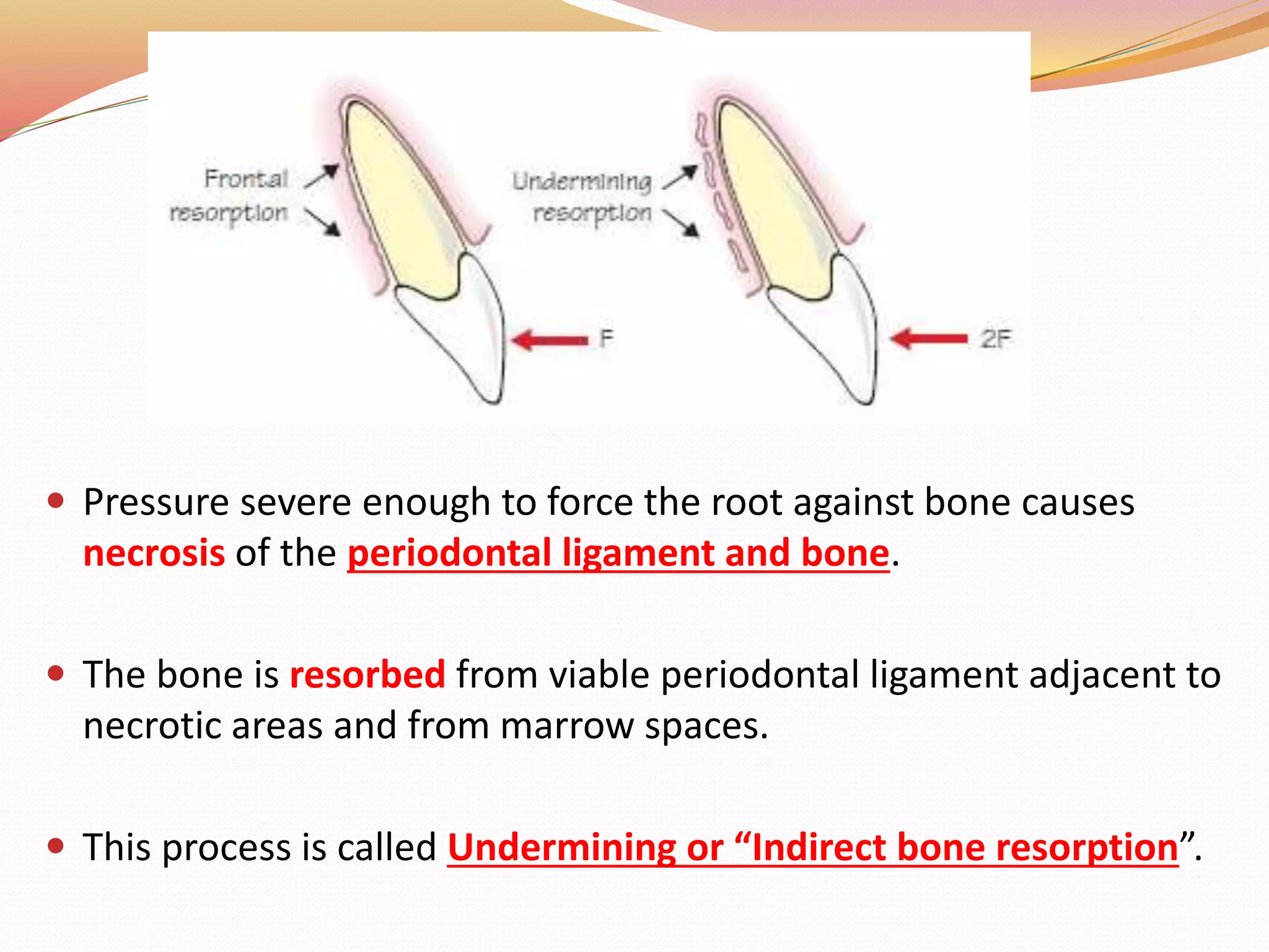  Pressure severe enough to force the root against bone causes
necrosis of the periodontal ligament and bone.
 The bone is resorbed from viable periodontal ligament adjacent to
necrotic areas and from marrow spaces.
 This process is called Undermining or “Indirect bone resorption”.
 