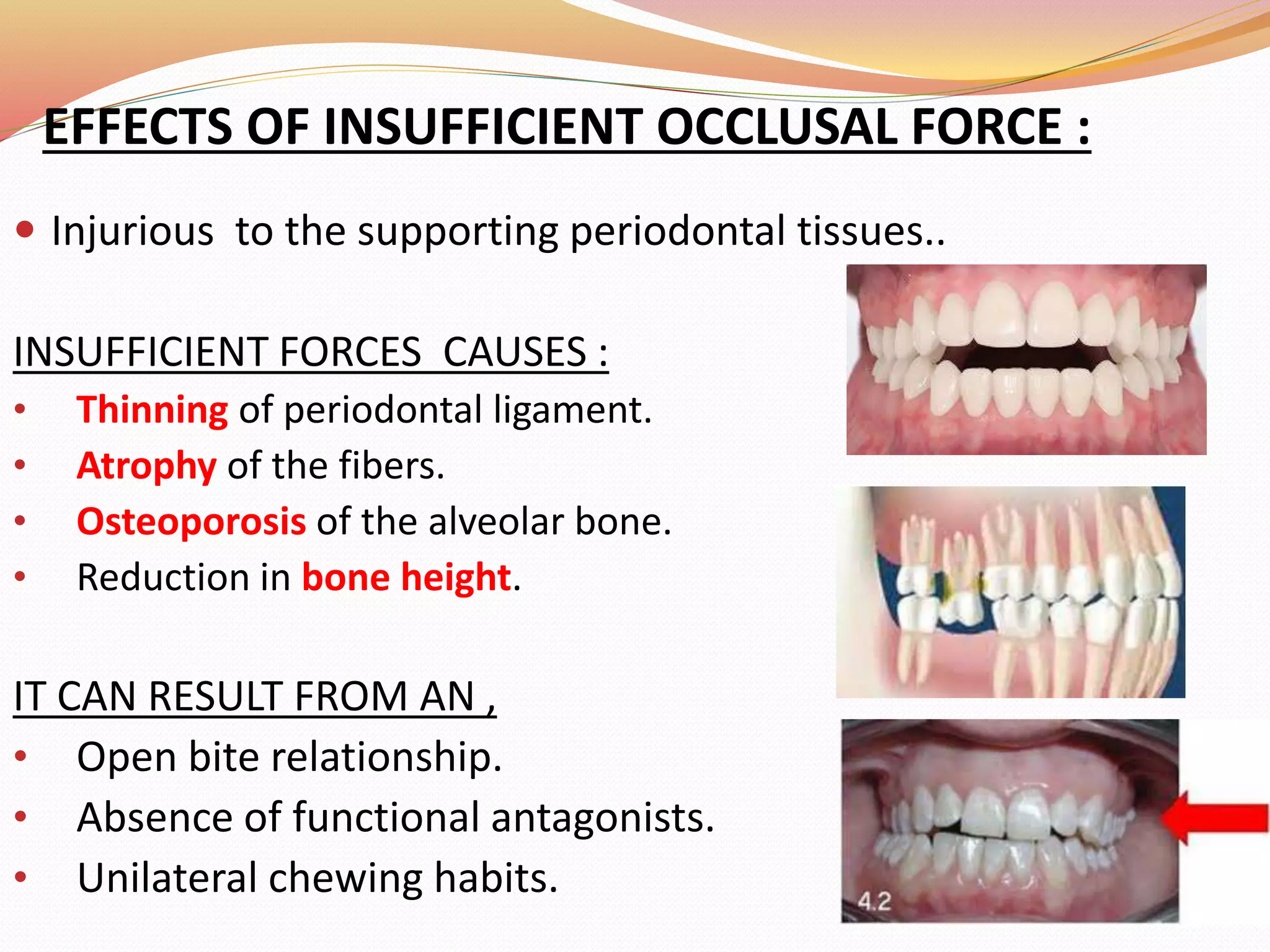 EFFECTS OF INSUFFICIENT OCCLUSAL FORCE :
 Injurious to the supporting periodontal tissues..
INSUFFICIENT FORCES CAUSES :
• Thinning of periodontal ligament.
• Atrophy of the fibers.
• Osteoporosis of the alveolar bone.
• Reduction in bone height.
IT CAN RESULT FROM AN ,
• Open bite relationship.
• Absence of functional antagonists.
• Unilateral chewing habits.
 