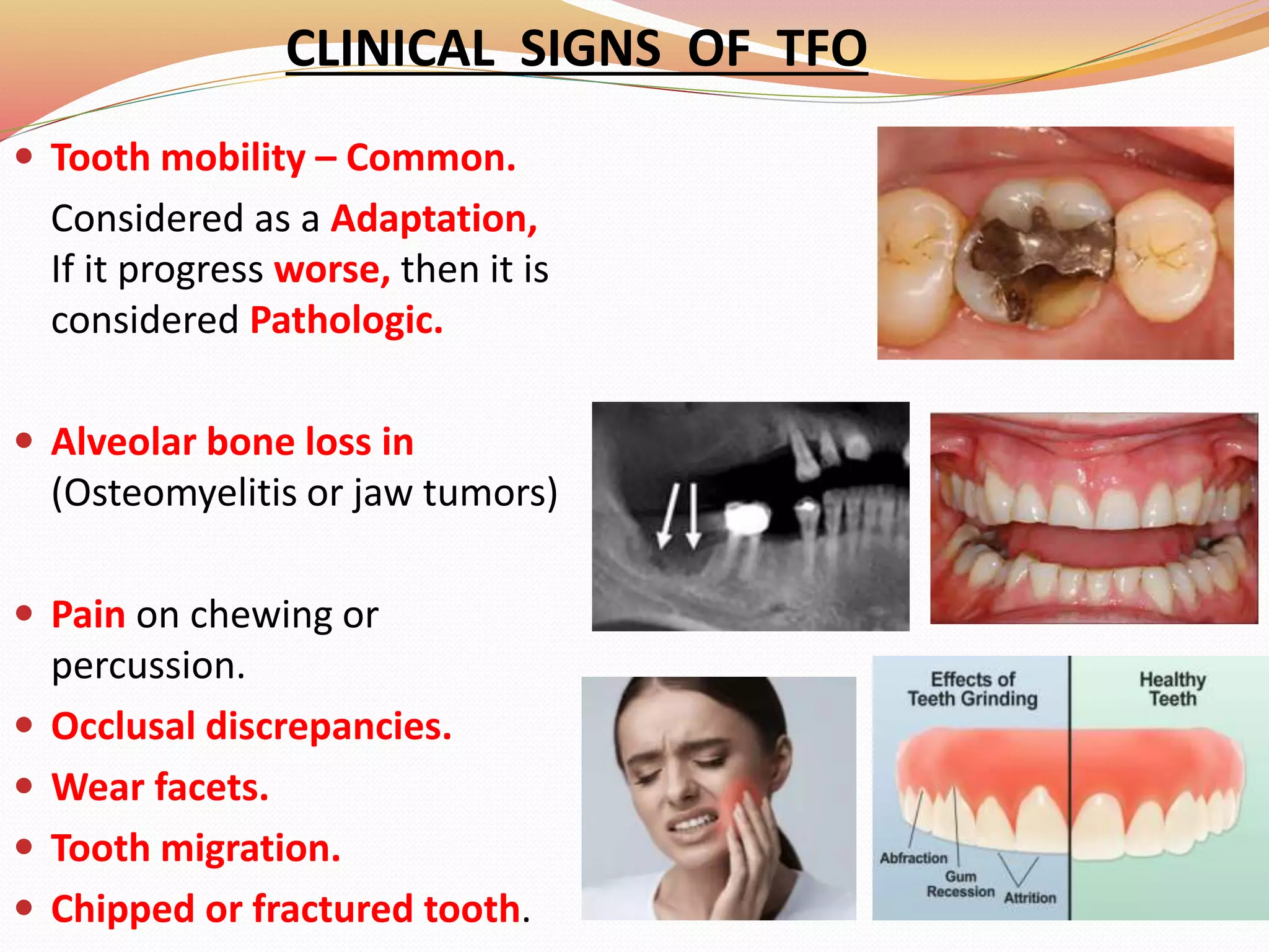 CLINICAL SIGNS OF TFO
 Tooth mobility – Common.
Considered as a Adaptation,
If it progress worse, then it is
considered Pathologic.
 Alveolar bone loss in
(Osteomyelitis or jaw tumors)
 Pain on chewing or
percussion.
 Occlusal discrepancies.
 Wear facets.
 Tooth migration.
 Chipped or fractured tooth.
 