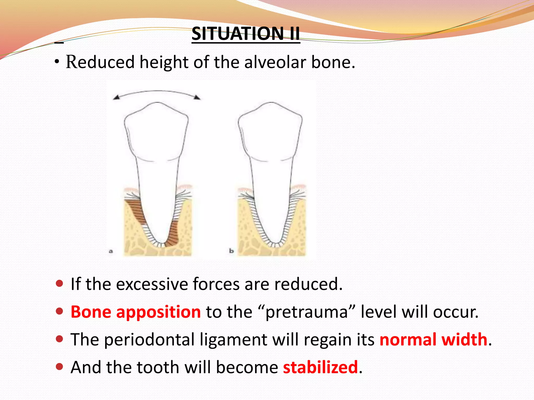 SITUATION II
• Reduced height of the alveolar bone.
 If the excessive forces are reduced.
 Bone apposition to the “pretrauma” level will occur.
 The periodontal ligament will regain its normal width.
 And the tooth will become stabilized.
 