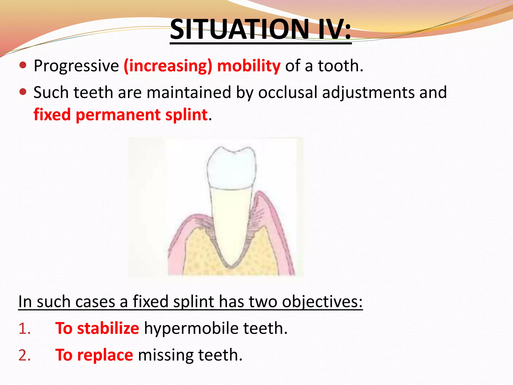 SITUATION IV:
 Progressive (increasing) mobility of a tooth.
 Such teeth are maintained by occlusal adjustments and
fixed permanent splint.
In such cases a fixed splint has two objectives:
1. To stabilize hypermobile teeth.
2. To replace missing teeth.
 