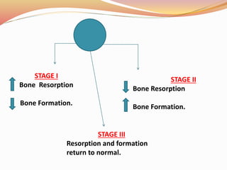 Trauma from occlusion. | PPTX