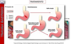 traumatismo gastrico manejo cirugía general | PPTX