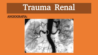 Trauma Renal
ANGIOGRAFIA:
 