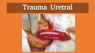 Trauma Uretral
 