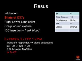 Resus
Intubation
Bilateral ICC’s
Right Lower Limb splint
Scalp wound closure
IDC insertion – frank blood
6 x PRBCs, 2 x FFP, 1 x Plat
Transient responder, ++ blood dependent
sBP 90 ! 120 ! 70
R Subclavian MAC line
! To CT
pH 7.1
Base Excess -10
Bicarbonate 19 (24)
INR 1.4
Lactate 6.9 (<2)
 