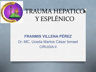 TRAUMA HEPATICO
Y ESPLÉNICO
FRANMIS VILLENA PÉREZ
Dr: MC. Uceda Martos César Ismael
CIRUGIA II
 