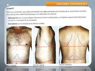 ANATOMIA TOPOGRAFICA
 