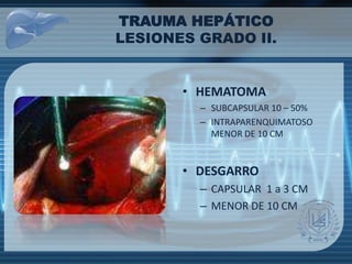 TRAUMA HEPÁTICO
LESIONES GRADO II.
• HEMATOMA
– SUBCAPSULAR 10 – 50%
– INTRAPARENQUIMATOSO
MENOR DE 10 CM
• DESGARRO
– CAPSULAR 1 a 3 CM
– MENOR DE 10 CM
 