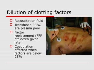 Dilution of clotting factors
 Resuscitation fluid
 Transfused PRBC
are plasma poor
 Factor
replacement (FFP
etc)often given
late
 Coagulation
affected when
factors are below
25%
 