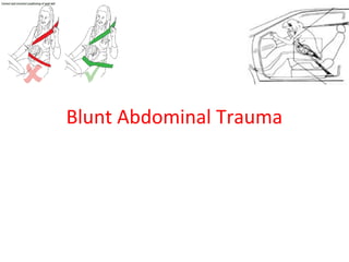 Blunt Abdominal Trauma
 