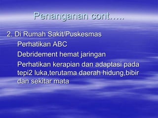 Penanganan cont…..
2. Di Rumah Sakit/Puskesmas
Perhatikan ABC
Debridement hemat jaringan
Perhatikan kerapian dan adaptasi pada
tepi2 luka,terutama daerah hidung,bibir
dan sekitar mata
 