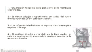 1.- Una incisión horizontal en la piel a nivel de la membrana
cricotiroidea.
2.- Se elevan colgajos subplatismales por arriba del hueso
hioides y por debajo del cartílago cricoides.
3.- Los músculos infrahioideos se separan lateralmente para
exponer la laringe.
4.- El cartílago tiroides es incidido en la línea media, se
extiende superiormente a través de la comisura anterior de la
membrana tiroidea.
Flint, P. et al. (2021). Cummings. Otolaryngology–head and neck surgery. Estados Unidos: Elsevier
Saunders.
Johnson, JT- & Rosen, CA. (2014). Bailey’s head & neck surgery. Otolaryngology. Estados Unidos: Lippincott Williams
& Wilkins.
Pasha, R & Golub, J. (2018). Otolaryngology – Head and neck surgery. Clinical Reference Guide. Estados Unidos:
 