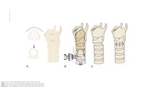 Flint, P. et al. (2021). Cummings. Otolaryngology–head and neck surgery. Estados Unidos: Elsevier
Saunders.
Johnson, JT- & Rosen, CA. (2014). Bailey’s head & neck surgery. Otolaryngology. Estados Unidos: Lippincott Williams
& Wilkins.
Pasha, R & Golub, J. (2018). Otolaryngology – Head and neck surgery. Clinical Reference Guide. Estados Unidos:
 