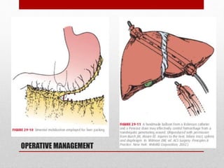 OPERATIVE MANAGEMENT
• Bile leaks
• Abscess
• Hemorrhage
• Devascularization
 