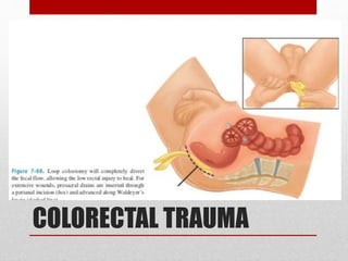 COLORECTAL TRAUMA
 