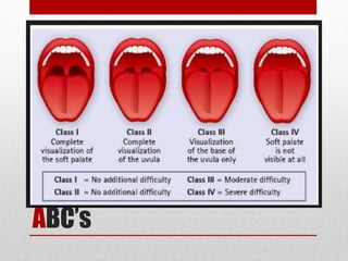 ABC’s
Airway Management
With Cervical Spine
Protection
 