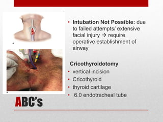 ABC’s
• Intubation Not Possible: due
to failed attempts/ extensive
facial injury  require
operative establishment of
airway
Cricothyroidotomy
• vertical incision
• Cricothyroid
• thyroid cartilage
• 6.0 endotracheal tube
Airway Management
With Cervical Spine
Protection
 