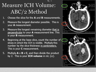 • Abc/2 formula here
 