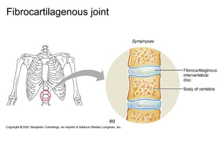 Fibrocartilagenous joint
 