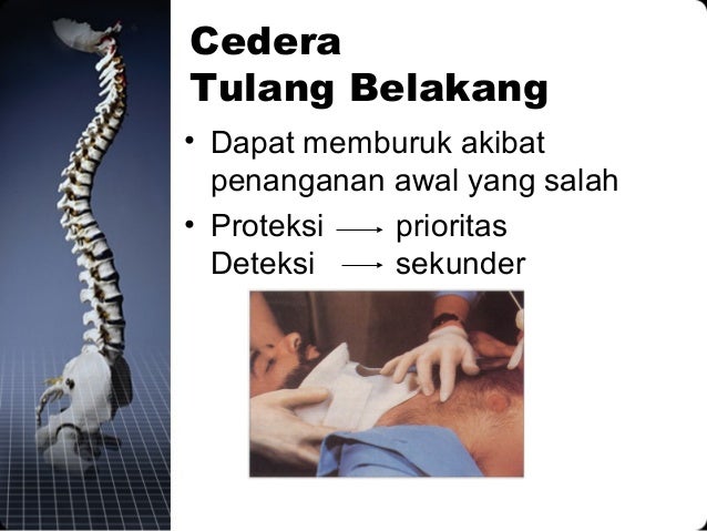 Trauma leher dan tulang belakang