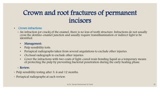 Infraction Tooth Trauma management | PPTX
