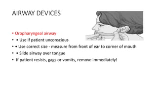 AIRWAY DEVICES
• Oropharyngeal airway
• • Use if patient unconscious
• • Use correct size - measure from front of ear to corner of mouth
• • Slide airway over tongue
• If patient resists, gags or vomits, remove immediately!
 