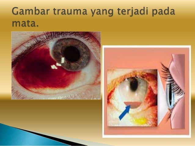 Trauma Mata