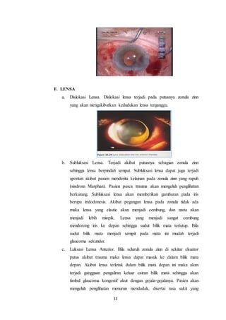 11
F. LENSA
a. Dislokasi Lensa. Dislokasi lensa terjadi pada putusnya zonula zinn
yang akan mengakibatkan kedudukan lensa terganggu.
b. Subluksasi Lensa. Terjadi akibat putusnya sebagian zonula zinn
sehingga lensa berpindah tempat. Subluksasi lensa dapat juga terjadi
spontan akibat pasien menderita kelainan pada zonula zinn yang rapuh
(sindrom Marphan). Pasien pasca trauma akan mengeluh penglihatan
berkurang. Subluksasi lensa akan memberikan gambaran pada iris
berupa iridodonesis. Akibat pegangan lensa pada zonula tidak ada
maka lensa yang elastic akan menjadi cembung, dan mata akan
menjadi lebih miopik. Lensa yang menjadi sangat cembung
mendorong iris ke depan sehingga sudut bilik mata tertutup. Bila
sudut bilik mata menjadi sempit pada mata ini mudah terjadi
glaucoma sekunder.
c. Luksasi Lensa Anterior. Bila seluruh zonula zinn di sekitar ekuator
putus akibat trauma maka lensa dapat masuk ke dalam bilik mata
depan. Akibat lensa terletak dalam bilik mata depan ini maka akan
terjadi gangguan pengaliran keluar cairan bilik mata sehingga akan
timbul glaucoma kongestif akut dengan gejala-gejalanya. Pasien akan
mengeluh penglihatan menurun mendadak, disertai rasa sakit yang
 