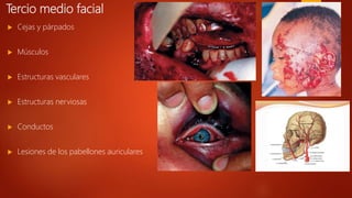 Tercio medio facial
 Cejas y párpados
 Músculos
 Estructuras vasculares
 Estructuras nerviosas
 Conductos
 Lesiones de los pabellones auriculares
 