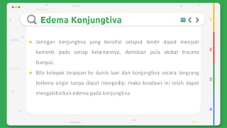 Trauma mekanik mata