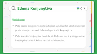 Trauma mekanik mata