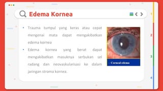 Trauma mekanik mata