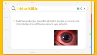 Trauma mekanik mata