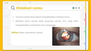 Trauma mekanik mata