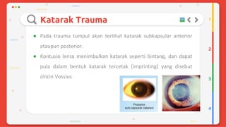 Trauma mekanik mata
