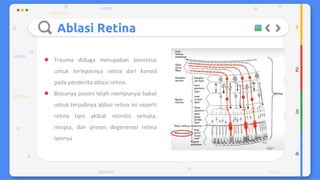 Trauma mekanik mata