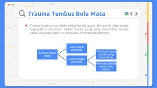 Trauma mekanik mata