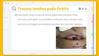 Trauma mekanik mata
