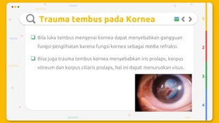 Trauma mekanik mata