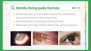 Trauma mekanik mata