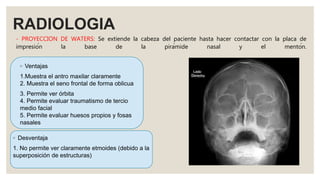 RADIOLOGIA
- PROYECCION DE WATERS: Se extiende la cabeza del paciente hasta hacer contactar con la placa de
impresión la base de la pirámide nasal y el mentón.
◦ Ventajas
1.Muestra el antro maxilar claramente
2. Muestra el seno frontal de forma oblicua
3. Permite ver órbita
4. Permite evaluar traumatismo de tercio
medio facial
5. Permite evaluar huesos propios y fosas
nasales
◦ Desventaja
1. No permite ver claramente etmoides (debido a la
superposición de estructuras)
 
