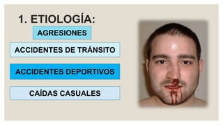 1. ETIOLOGÍA:
AGRESIONES
ACCIDENTES DE TRÁNSITO
ACCIDENTES DEPORTIVOS
CAÍDAS CASUALES
 
